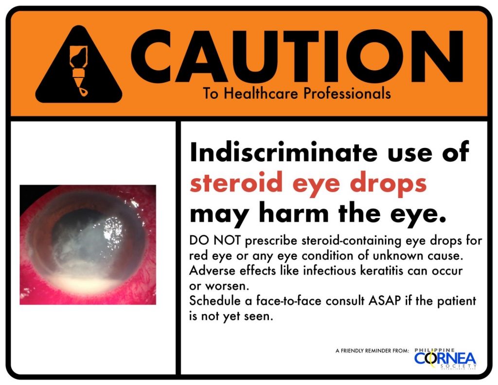 Indiscriminate Use of Steroid Eye Drops