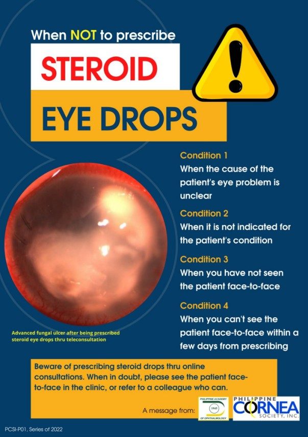 When_not_to_prescribe_steroid